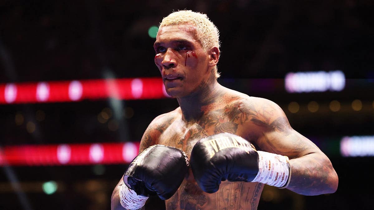 Conor Benn with blood running down his cheek during a boxing match at Tottenham Hotspur Stadium