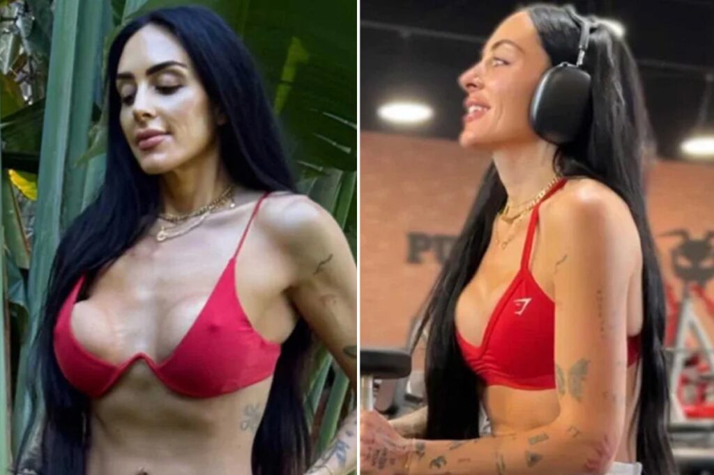 I survived two botched boob jobs — here’s why I have no regrets I survived two botched boob jobs — here’s why I have no regrets