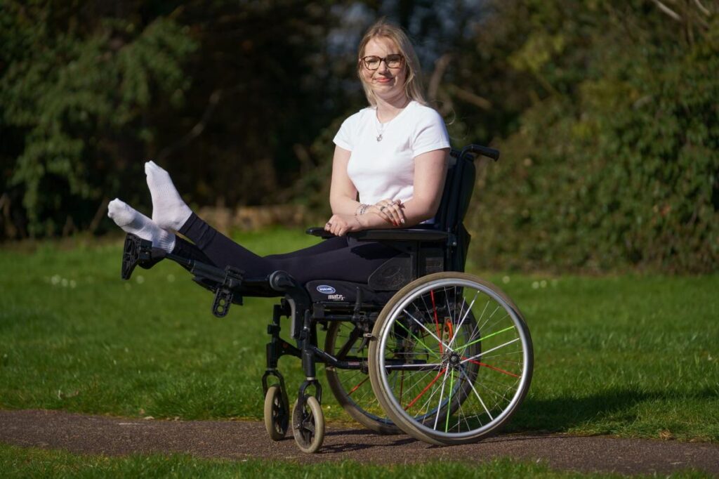 21-year-old to have legs amputated after legs locked straight, bent backwards