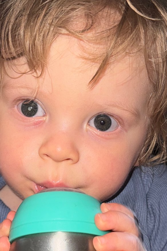 Peter’s parents noticed something was wrong when a reflection showed up in his right pupil.