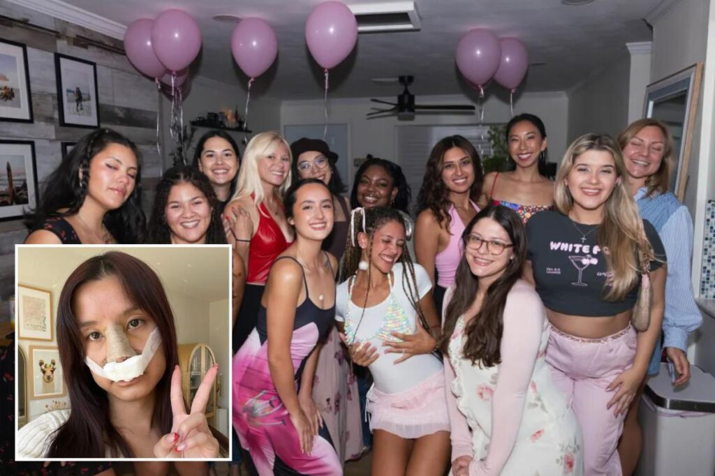 Inside the plastic surgery parties young people are throwing to celebrate boob jobs and rhinoplasty: ‘New nose who dis?