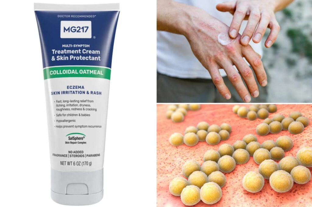 Skin cream sold on Amazon recalled over deadly bacteria risk