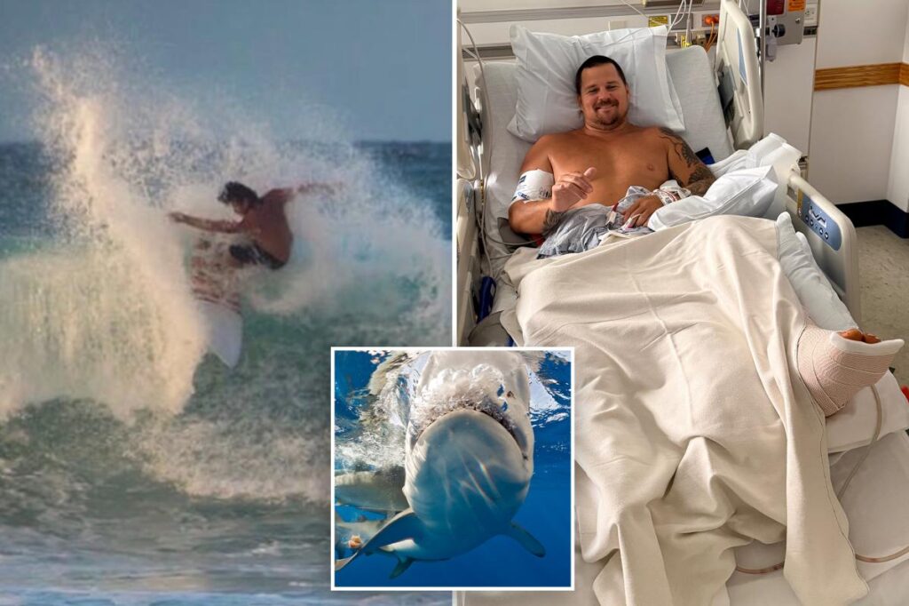 Surfer describes how 8-foot shark ripped open his legs: ‘My calf is pretty much wide open’ Surfer describes how 8-foot shark ripped open his legs: ‘My calf is pretty much wide open’