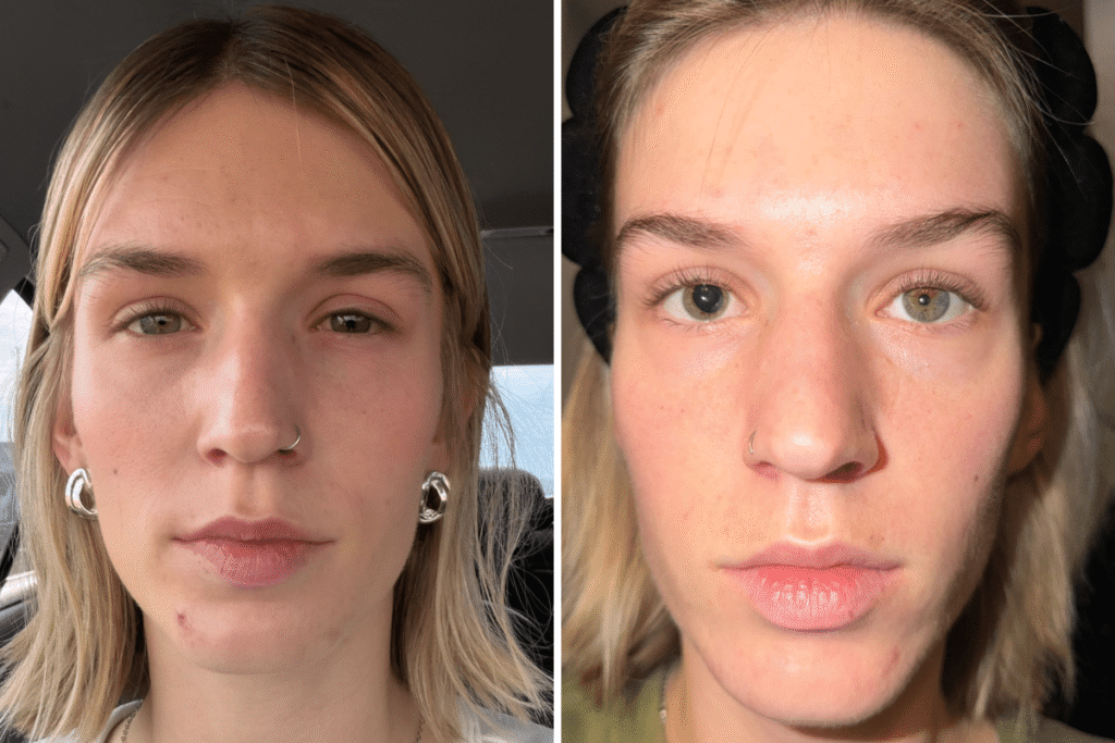 Woman Hit in Eye by Nerf Gun While Babysitting—Here’s What Happened After 