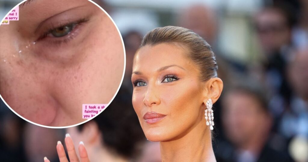 Bella Hadid Tears Up, Details Chronic Illness From Lyme Disease: ‘Overwhelming Amount of Emotion’