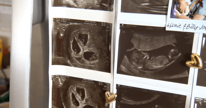 Quebec single mother welcomes triplets after years of fertility struggles Quebec single mother welcomes triplets after years of fertility struggles