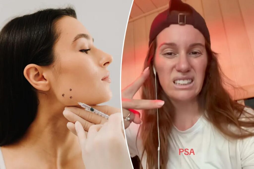 Comedian Hannah Berner reveals distressing side effect of TMJ treatment: ‘Pray for me’ Comedian Hannah Berner reveals distressing side effect of TMJ treatment: ‘Pray for me’