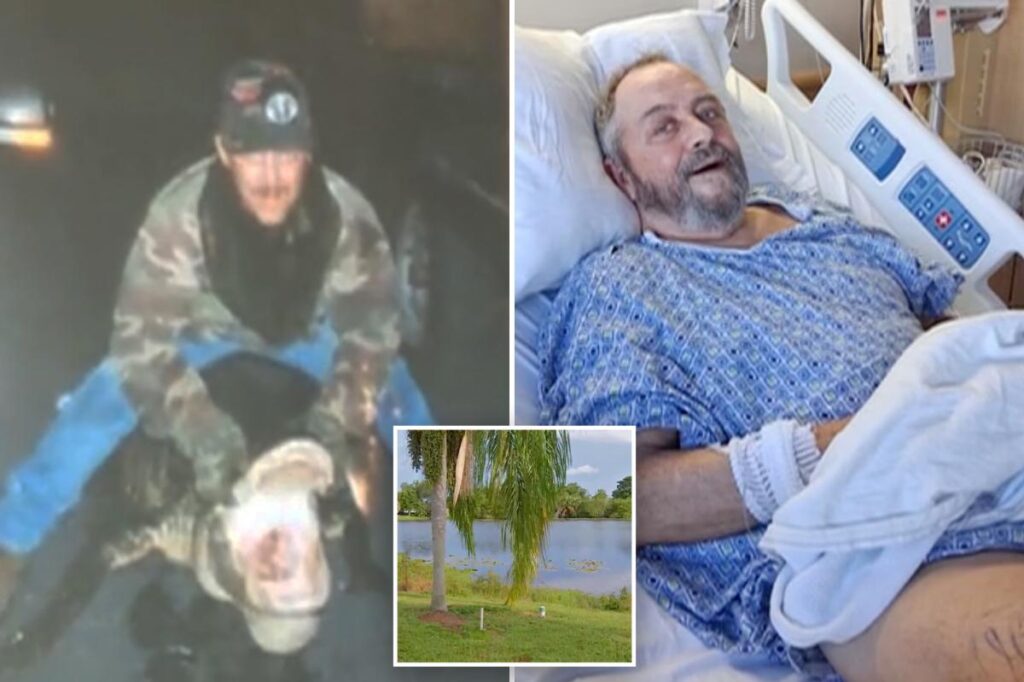 How a Florida senior fought off alligator attack with fishing pole: ‘No gator is going to run me off’