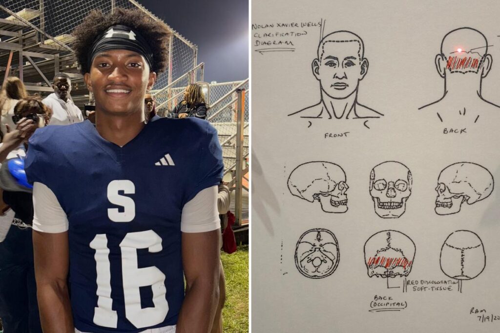 Nolan Wells’ state autopsy complete and in hands of sheriff’s office: report