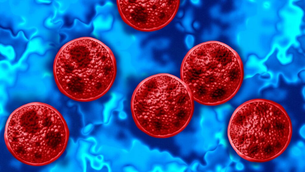 A Diarrhea-Causing Parasite Is Spreading. Should You Stop Eating Salad? A Diarrhea-Causing Parasite Is Spreading. Should You Stop Eating Salad?