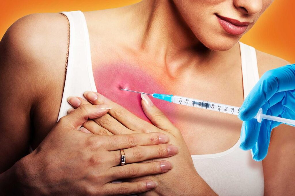 Exclusive | I got a boob job from a dead person’s fat — and it ruined my breasts forever