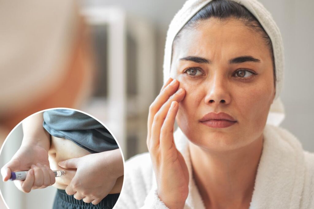 ‘Temporal wasting’: The GLP-1 side effect that makes patients ‘look suddenly older’
