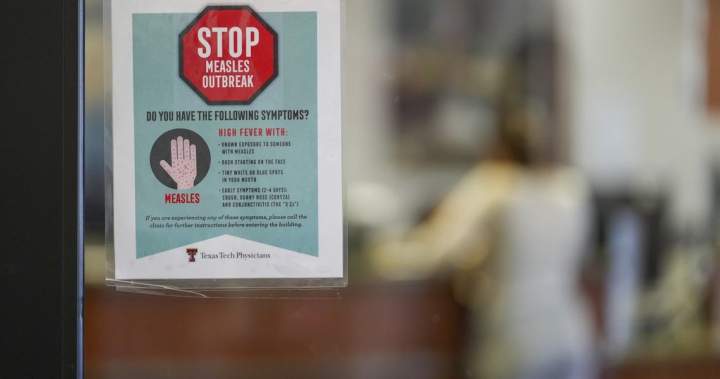 Canada’s measles cases are half of U.S. total, despite smaller population: WHO Canada’s measles cases are half of U.S. total, despite smaller population: WHO