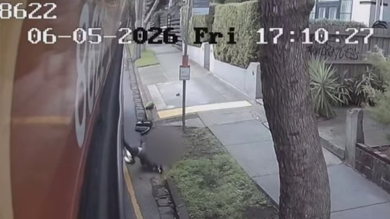 Shocking footage shows toddler’s legs trapped in doors Shocking footage shows toddler’s legs trapped in doors