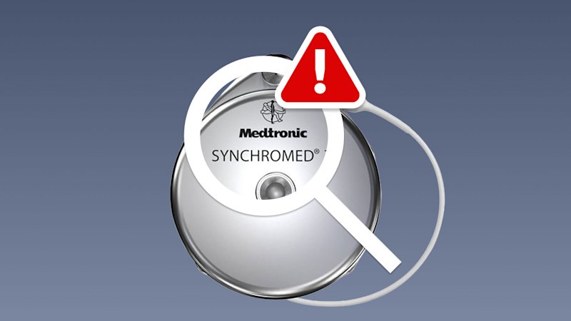 Regulator understaffed and struggling with legacy IT systems to monitor adverse event reports Regulator understaffed and struggling with legacy IT systems to monitor adverse event reports