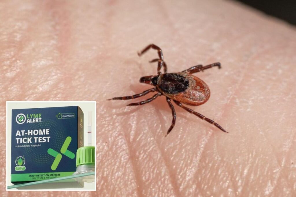 ‘TickCrusher’ kit that could help you dodge weeks of Lyme disease anxiety in 15 minutes ‘TickCrusher’ kit that could help you dodge weeks of Lyme disease anxiety in 15 minutes