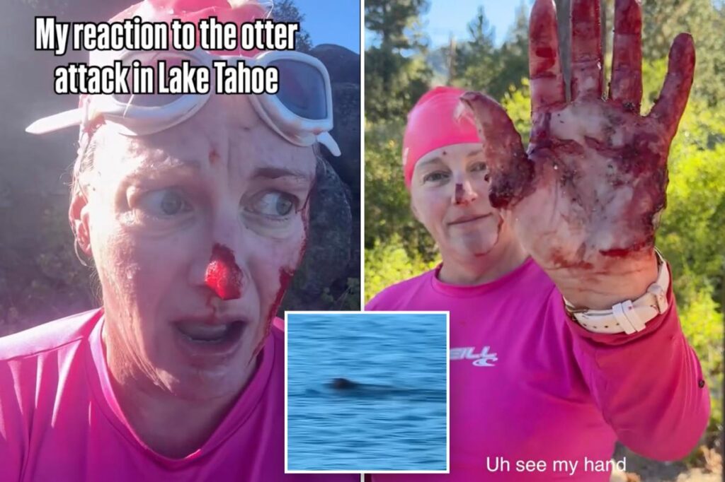 Swimmer mauled in vicious attack  by ‘ruthless’ river otter: ‘It just kept coming’