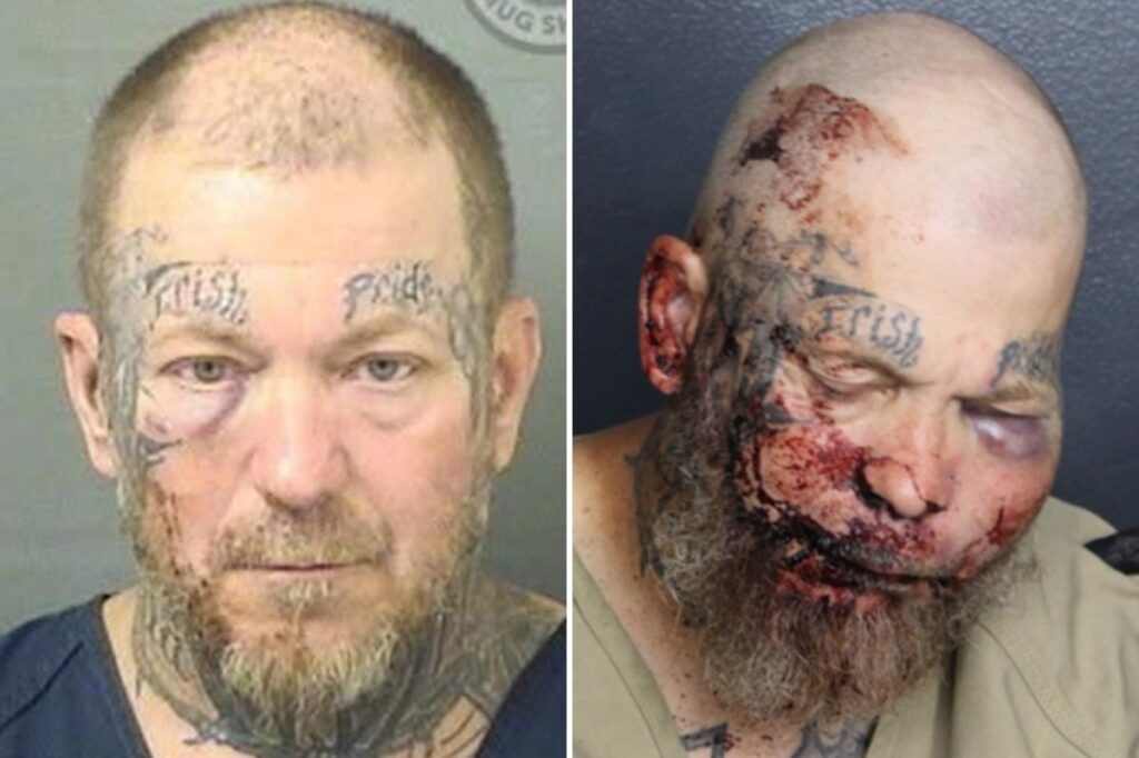 Florida man left with swollen face in mugshot after attacking cop inside hospital: ‘I want to fight you’