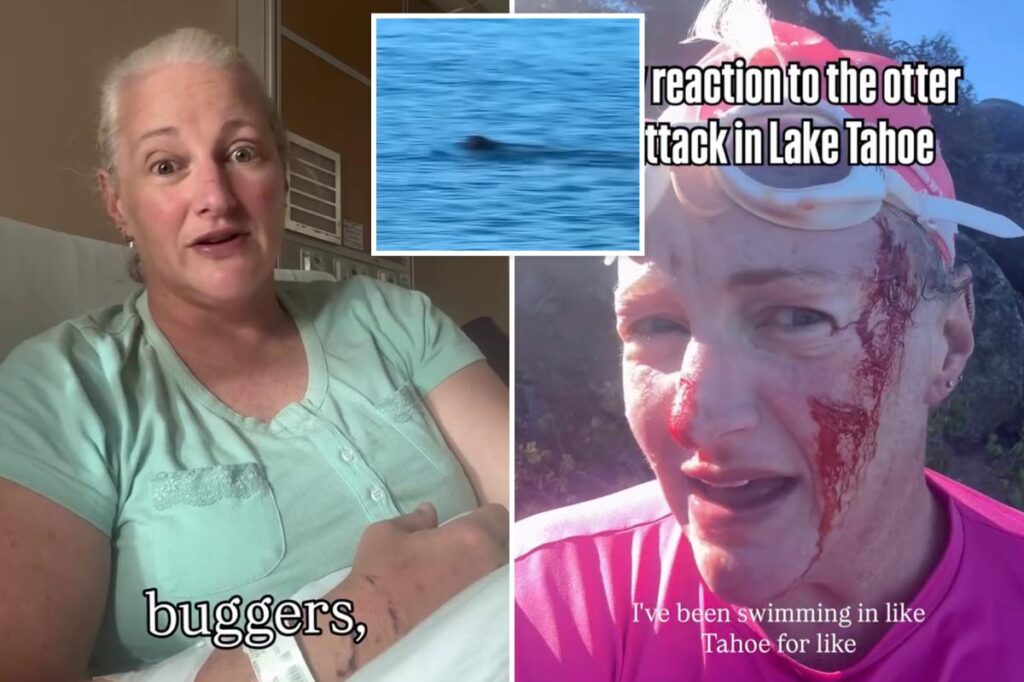 Lake Tahoe swimmer attacked by ‘ruthless’ otter undergoes surgery Lake Tahoe swimmer attacked by ‘ruthless’ otter undergoes surgery