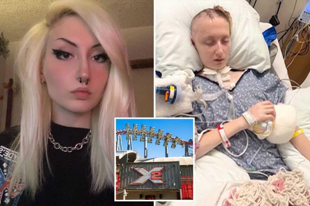 Harrowing pictures shows X2 rider still on ventilator two months after riding massive Six Flags coaster