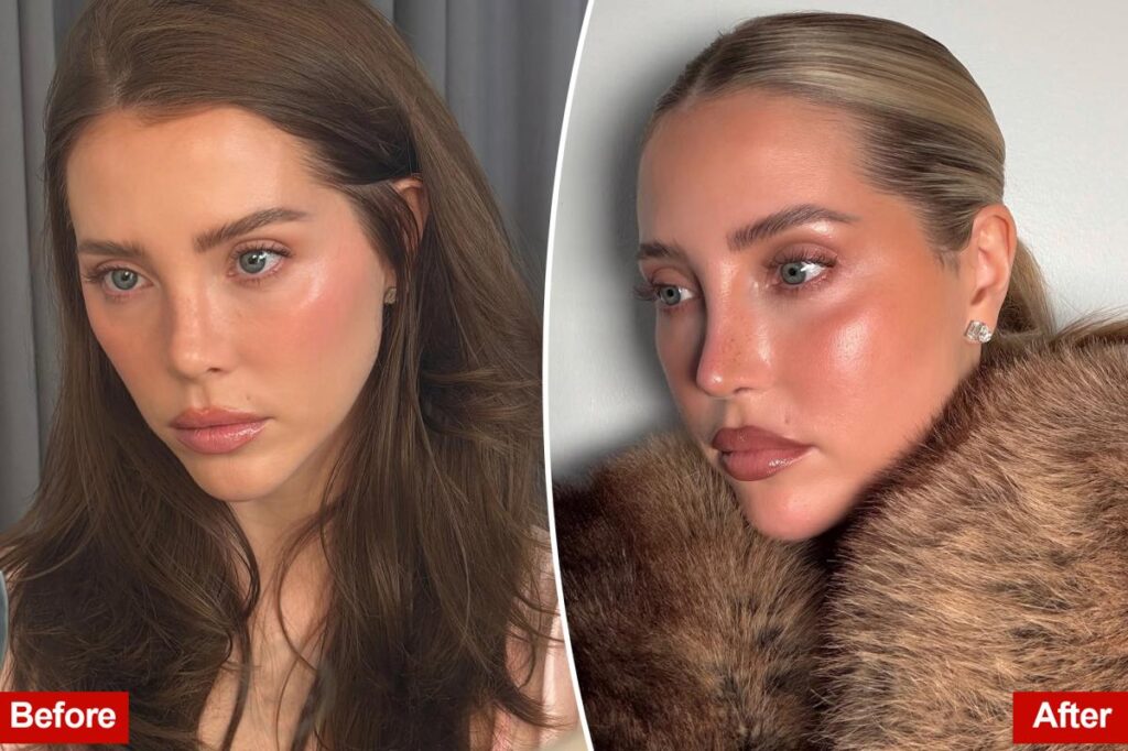 Why This Beauty Influencer Tried to Hide Her ,000 Beverly Hills Nose Job