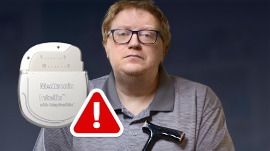 Marcus Barlow in 2025 with the spinal cord stimulation system.