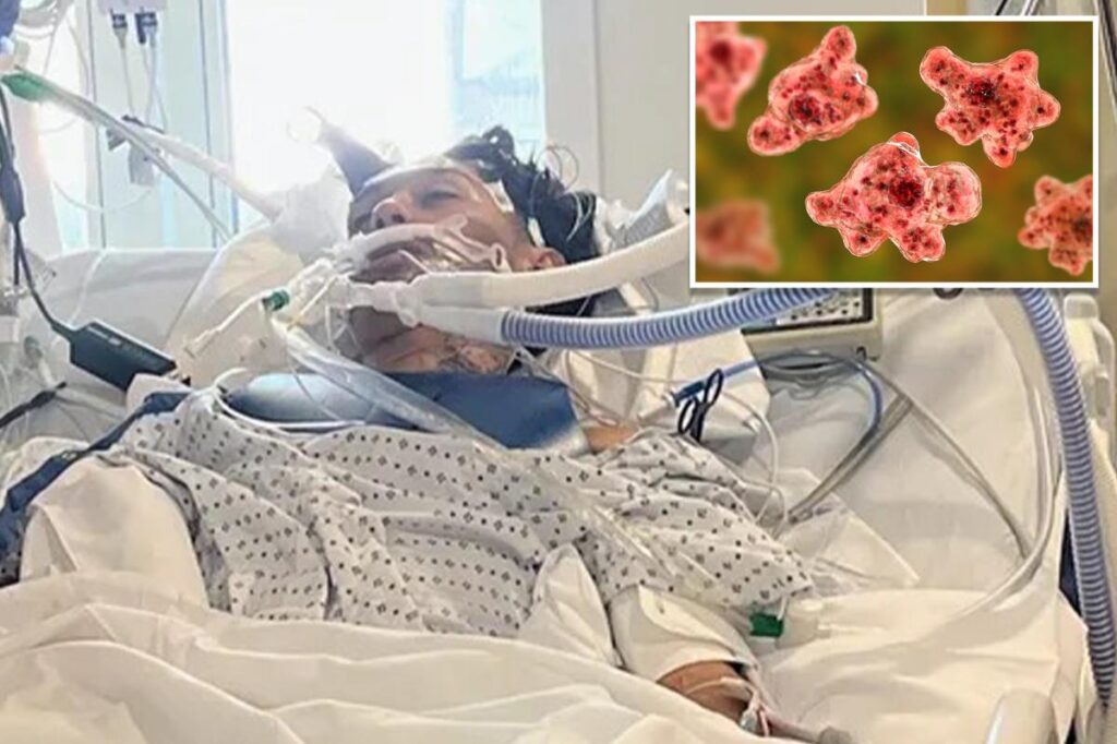 North Carolina teen dies from rare brain-eating amoeba typically linked to freshwater swimming North Carolina teen dies from rare brain-eating amoeba typically linked to freshwater swimming