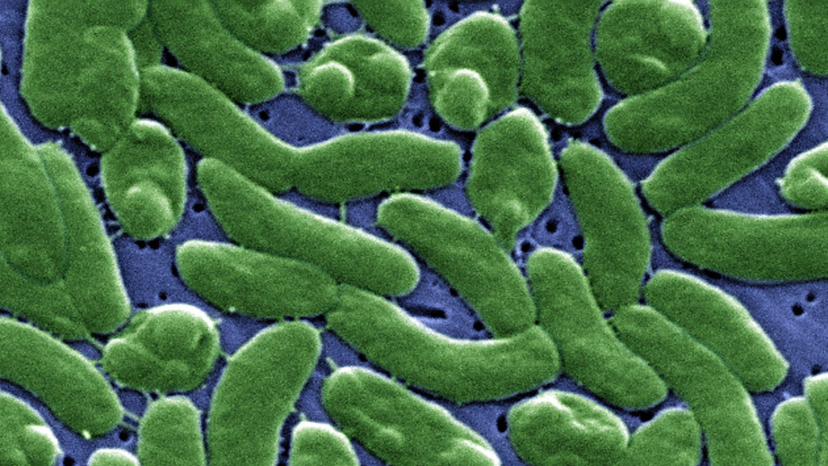 Vibrio vulnificus is a bacterium in the same family as those that cause cholera. It normally lives in warm seawater and is part of a group of vibrios that are called "halophilic" because they require salt. 