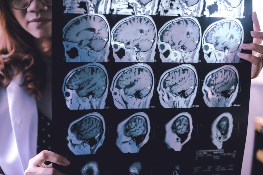 This family’s heartbreaking struggle with dementia in midlife may upend our understanding of the disease — and hope for a cure This family’s heartbreaking struggle with dementia in midlife may upend our understanding of the disease — and hope for a cure