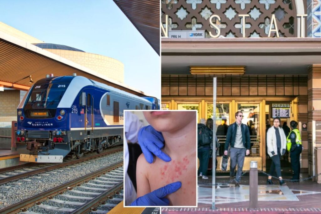 Measles panic after infected California Amtrak rider makes several stops across the state Measles panic after infected California Amtrak rider makes several stops across the state