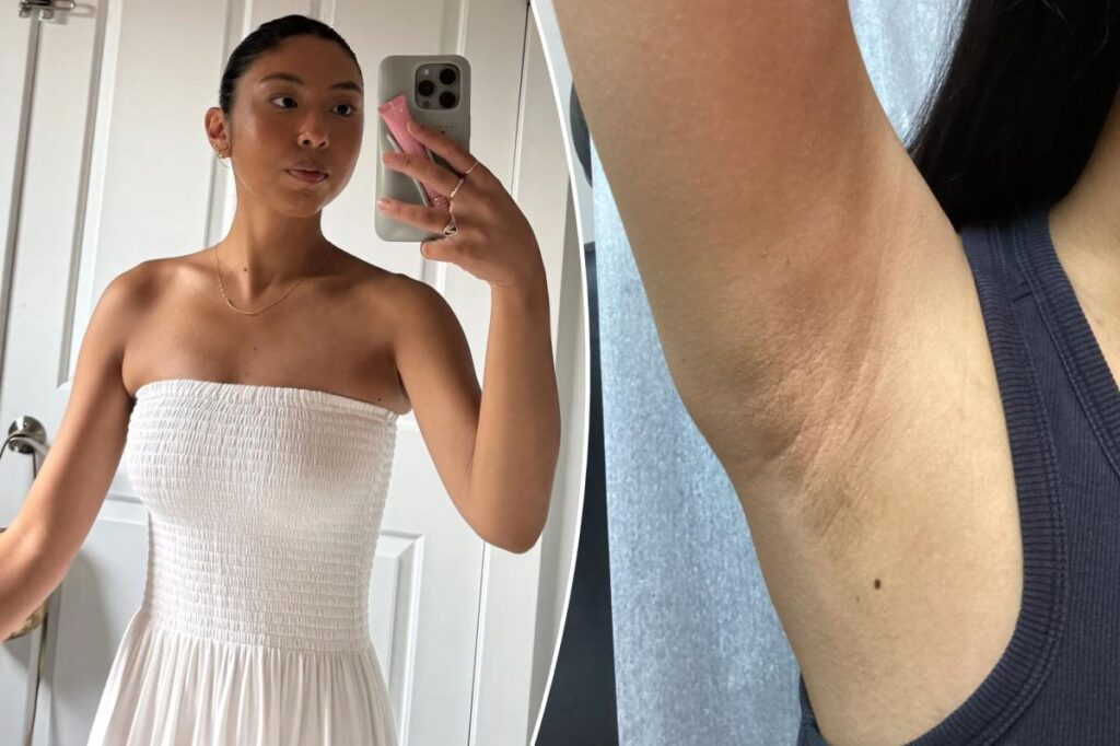 I developed a nasty skin condition from shaving my underarms — you could be making the same mistake I did